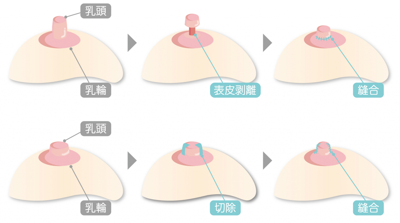 婦人科形成手術 ビューティーコアサポート 鹿児島市の分子栄養療法 美容外来 病気予防など